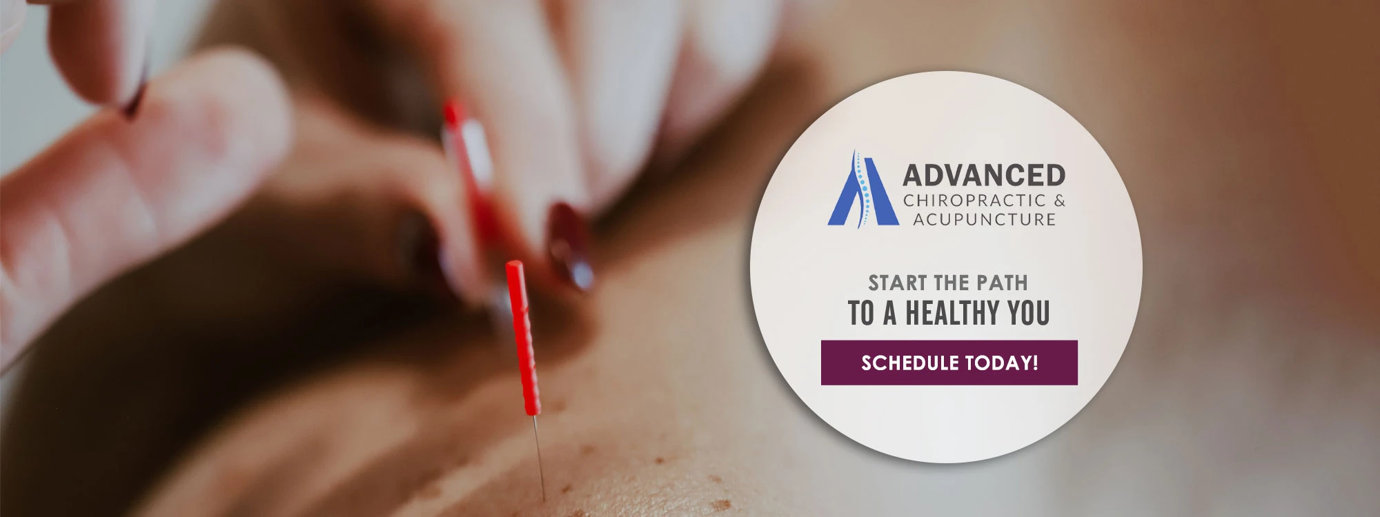 An acupuncturist performing treatment on a patient